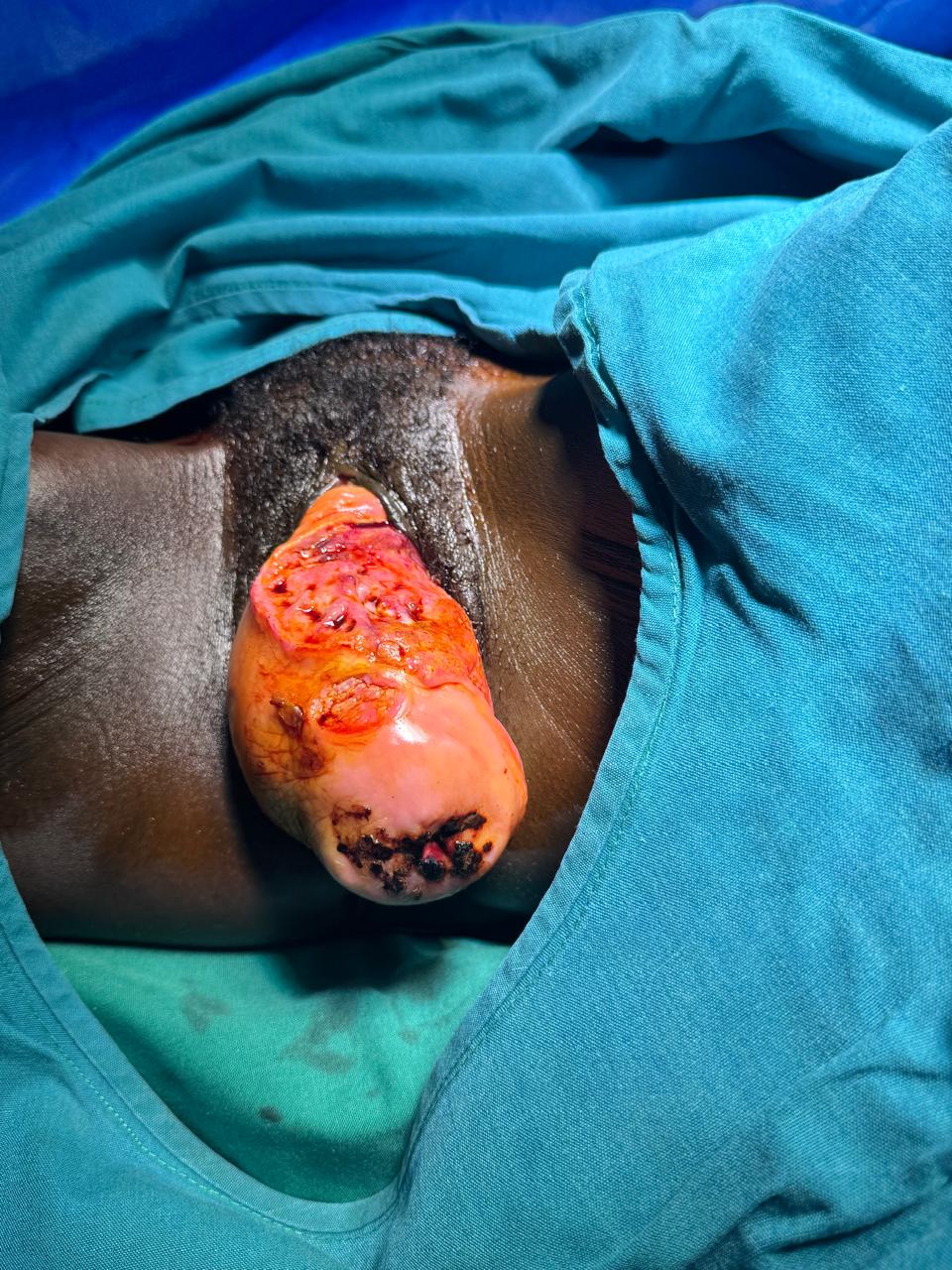 Vaginal cancer screening and care at Irys Medical Center